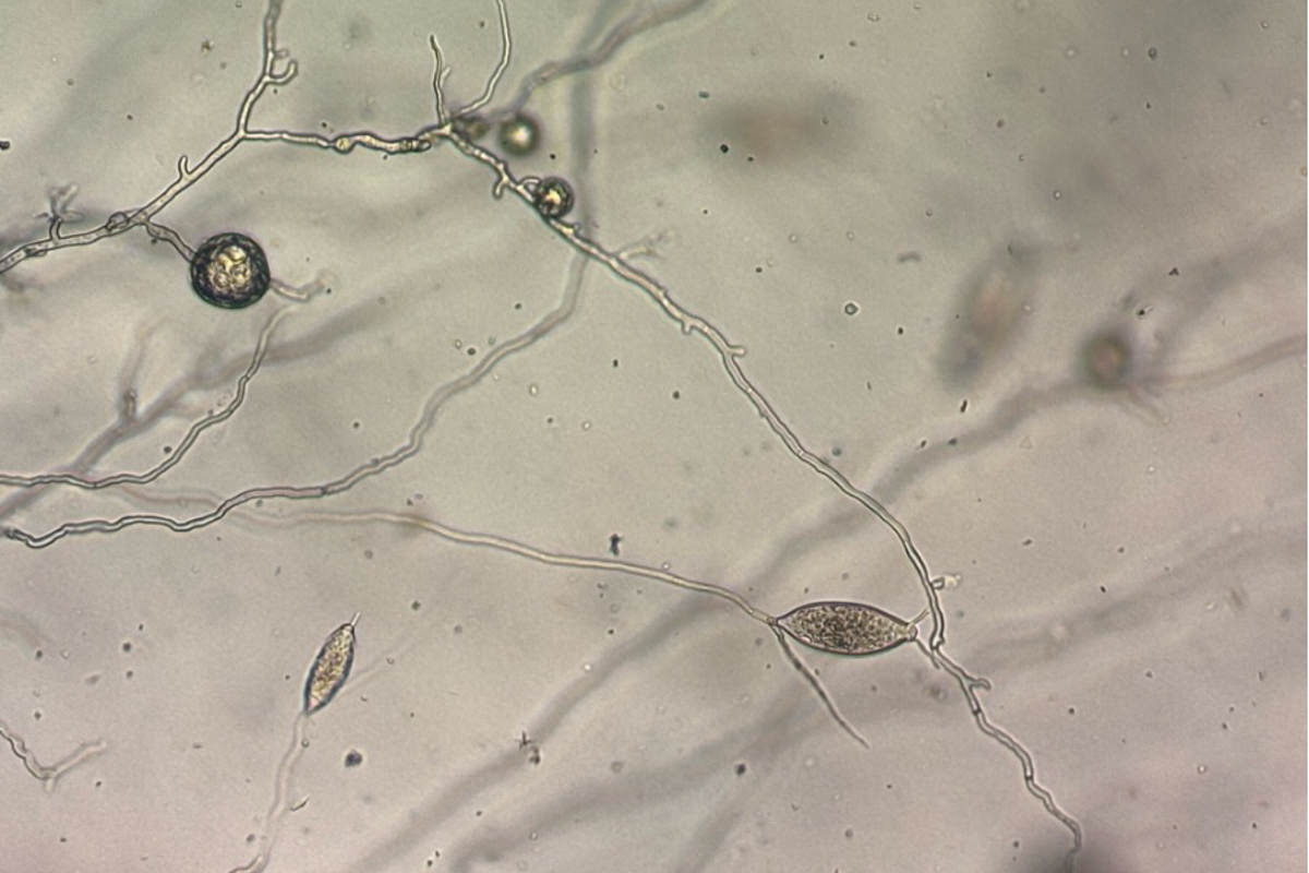 pathogen phytophthora ramorum under the microscope